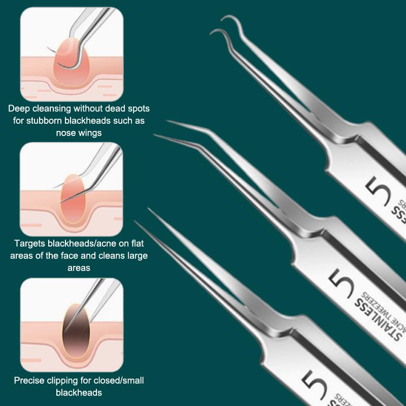 7/8개 블랙헤드 제거 키트 전문 블랙헤드 니들 스킨케 - Tool Set 리뷰 및 가격